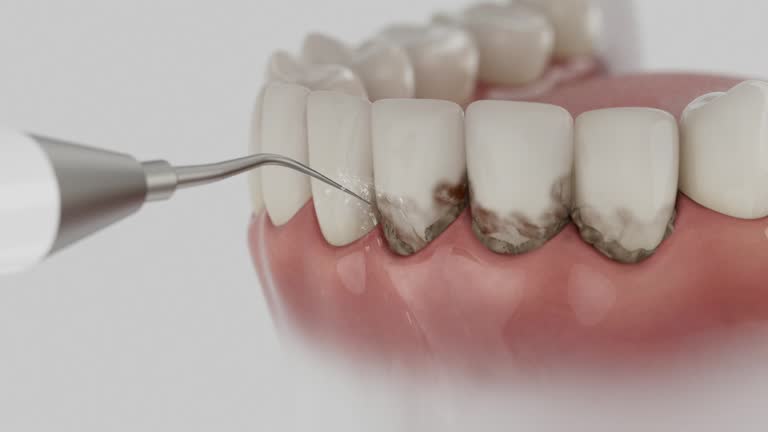 Trusted Tooth Extraction service in Pickens, MS - Dentist Open Now